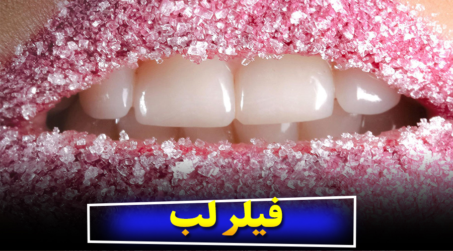 فیلر لب