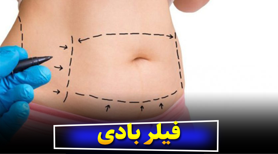 فیلر بادی