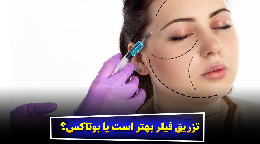 تزریق فیلر بهتر است یا بوتاکس؟ مقایسه کامل