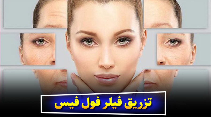 تزریق فیلر فول فیس