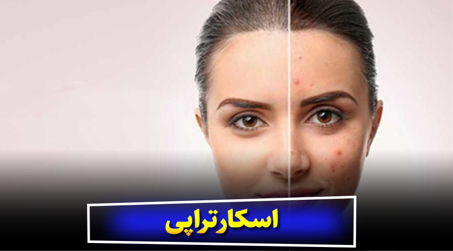 اسکارتراپی