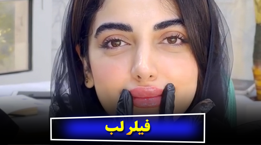 راهنمای کامل فیلر لب انواع تکنیک‌ها و نکات طلایی قبل از تزریق