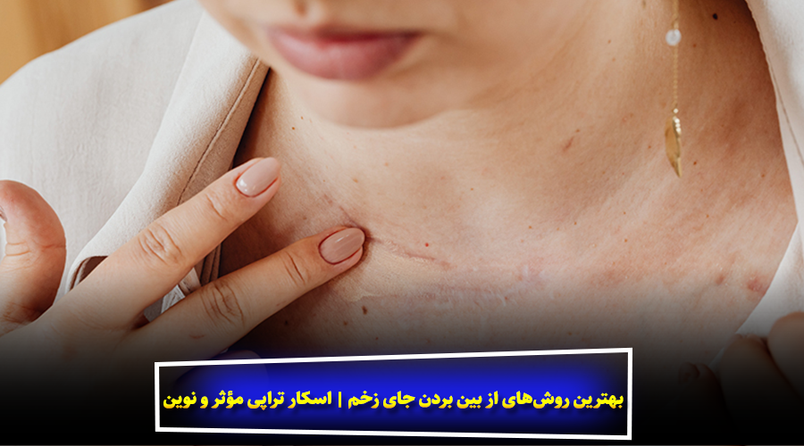 بهترین روش‌های از بین بردن جای زخم | اسکار تراپی مؤثر و نوین