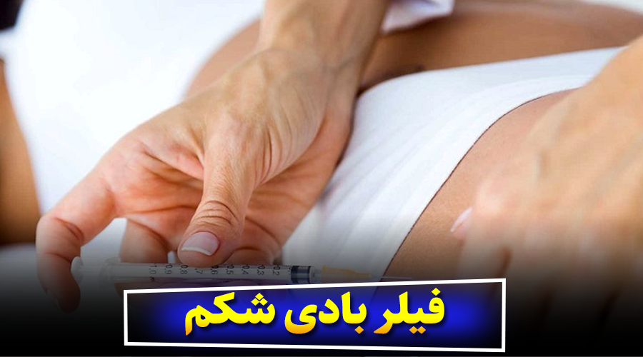 فیلر بادی شکم