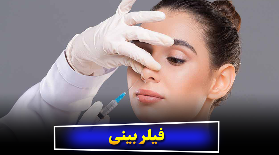 فیلر بینی