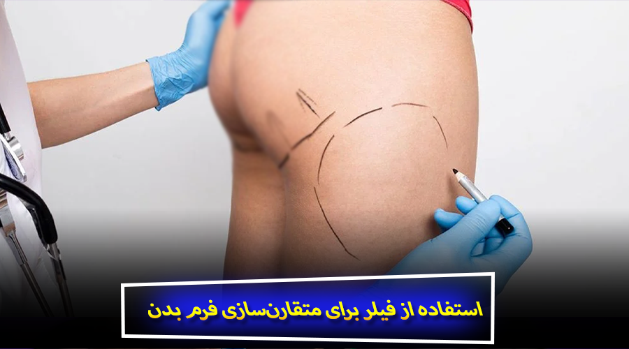 استفاده از فیلر برای متقارن‌سازی فرم بدن